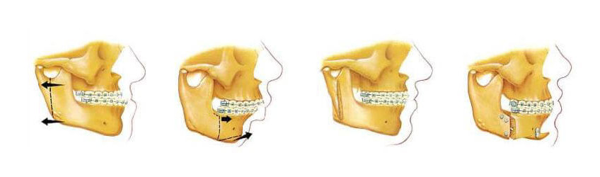 Of Oral And Maxiofacial 52